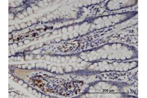 Image no. 1 for anti-Mannosyl (Alpha-1,6-)-Glycoprotein beta-1,6-N-Acetyl-Glucosaminyltransferase (MGAT5) (AA 642-740) antibody (ABIN599401) (MGAT5 antibody  (AA 642-740))