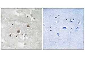 Immunohistochemistry (IHC) image for anti-Mitogen-Activated Protein Kinase Kinase Kinase 1 (MAP3K1) (pThr1402) antibody (ABIN1847608) (MAP3K1 antibody  (pThr1402))