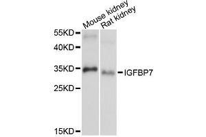 Western blot analysis of extracts of various cell lines, using IGFBP7 antibody (ABIN6293120) at 1:1000 dilution.