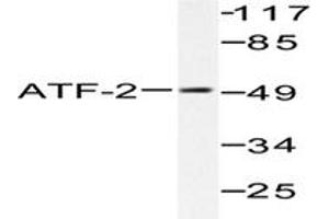 Image no. 1 for anti-Activating Transcription Factor 2 (ATF2) antibody (ABIN265318) (ATF2 antibody)