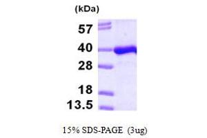 SDS-PAGE (SDS) image for Phosphotidylinositol Transfer Protein, beta (PITPNB) (AA 1-271) protein (His tag) (ABIN667260) (PITPNB Protein (AA 1-271) (His tag))
