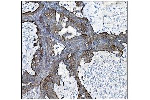 IHC analysis of CLPP using anti-CLPP antibody (ABIN5693176). (CLPP antibody  (AA 184-247))