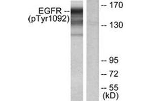 Western Blotting (WB) image for anti-Epidermal Growth Factor Receptor (EGFR) (pTyr1092) antibody (ABIN2888397) (EGFR antibody  (pTyr1092))