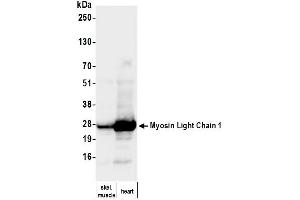 Western Blotting (WB) image for anti-Myosin, Light Chain 1, Alkali, Skeletal, Fast (MYL1) (Light Chain) antibody (ABIN7795615)