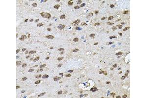 Immunohistochemistry of paraffin-embedded Rat brain using RNF166 Polyclonal Antibody