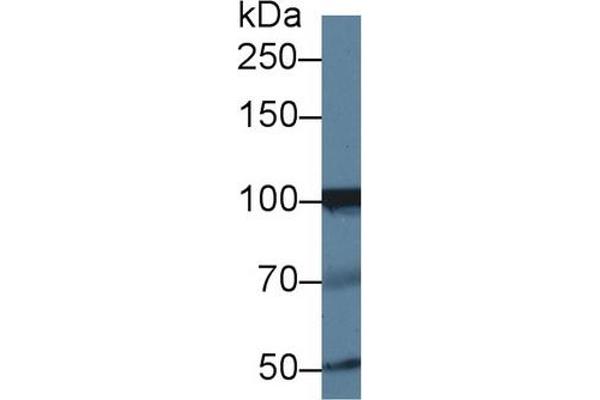 INPP4A Antikörper  (AA 1-137)