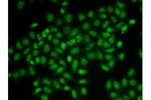 Immunofluorescence analysis of HeLa cells using COIL antibody (ABIN5973828). (Coilin antibody)