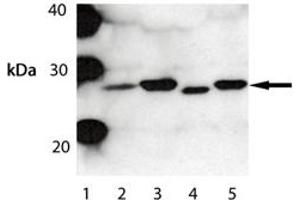 Western blot analysis of Bak . (BAK1 antibody)
