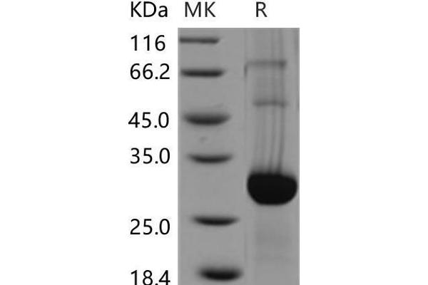 GLIPR1 Protein (His tag)