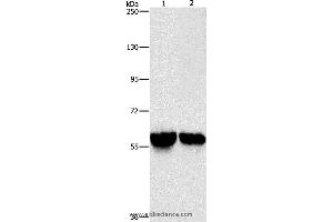 Western blot analysis of Mouse liver and kidney tissue, using ALDH8A1 Polyclonal Antibody at dilution of 1:800 (ALDH8A1 antibody)
