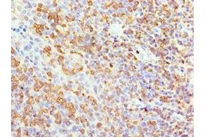 Immunohistochemistry of paraffin-embedded human tonsil tissue using ABIN7144041 at dilution of 1:100 (Amyloid beta (A4) Precursor Protein-Binding, Family B, Member 1 Interacting Protein (APBB1IP) (AA 1-150) antibody)