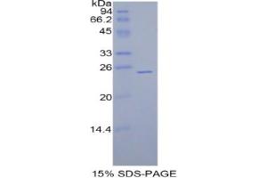 SDS-PAGE analysis of Rat GPX5 Protein. (GPX5 Protein)