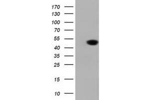 HEK293T cells were transfected with the pCMV6-ENTRY control (Left lane) or pCMV6-ENTRY DNAJA2 (Right lane) cDNA for 48 hrs and lysed. (DNAJA2 antibody)