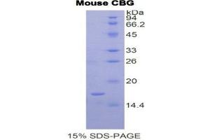 SDS-PAGE (SDS) image for serpin Peptidase Inhibitor, Clade A (Alpha-1 Antiproteinase, Antitrypsin), Member 6 (SERPINA6) (AA 268-391) protein (His tag) (ABIN1878377)