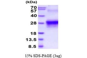 SDS-PAGE (SDS) image for Tumor Necrosis Factor (Ligand) Superfamily, Member 8 (TNFSF8) (AA 63-234) protein (His tag) (ABIN6387798)