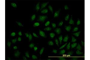 Immunofluorescence (IF) image for anti-Nuclear Receptor Subfamily 1, Group H, Member 4 (NR1H4) (AA 363-472) antibody (ABIN523347)