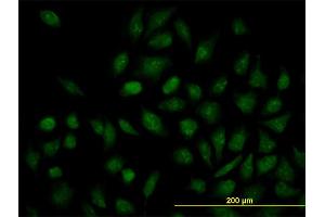 Immunofluorescence of monoclonal antibody to NR1H4 on HeLa cell. (NR1H4 antibody  (AA 363-472))