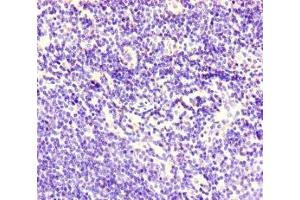 Immunohistochemistry of paraffin-embedded human lymph node tissue using ABIN7148573 at dilution of 1:100 (Corneodesmosin antibody  (AA 40-229))