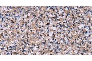 Immunohistochemistry (Paraffin-embedded Sections) (IHC (p)) image for anti-Nuclear Receptor Subfamily 1, Group D, Member 1 (NR1D1) antibody (ABIN7237541)