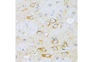 Immunohistochemistry (Paraffin-embedded Sections) (IHC (p)) image for anti-Cyclin D1 (CCND1) (C-Term) antibody (ABIN6138080)