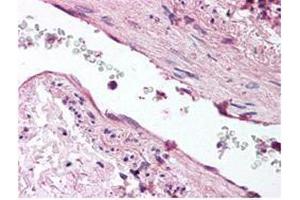 anti-ANG1 antibody was diluted 1:500 to detect ANG1 in human lung tissue. (Angiopoietin 1 antibody  (AA 15-45))