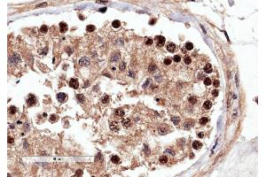 ABIN2564849 (4µg/ml) staining of paraffin embedded Human Testis. (RACGAP1 antibody  (C-Term))