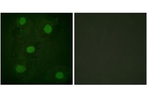 Immunofluorescence analysis of HeLa cells, using p53 (Ab-317) Antibody. (p53 antibody  (AA 283-332))