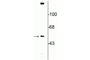 Western blot of rat striatal lysate showing specific immunolabeling of the ~57 kDa VMAT2 protein. (SLC18A2 antibody  (C-Term))