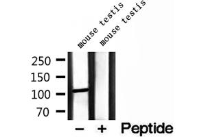 MMS19 antibody  (Internal Region)