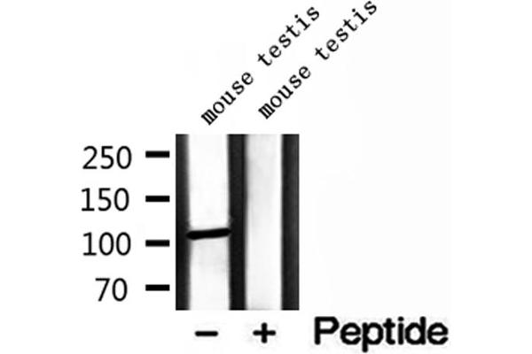 MMS19 antibody  (Internal Region)