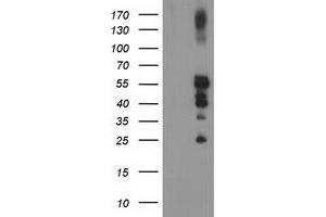 Western Blotting (WB) image for anti-Protein tyrosine Phosphatase, Non-Receptor Type 1 (PTPN1) antibody (ABIN1500496) (PTPN1 antibody)