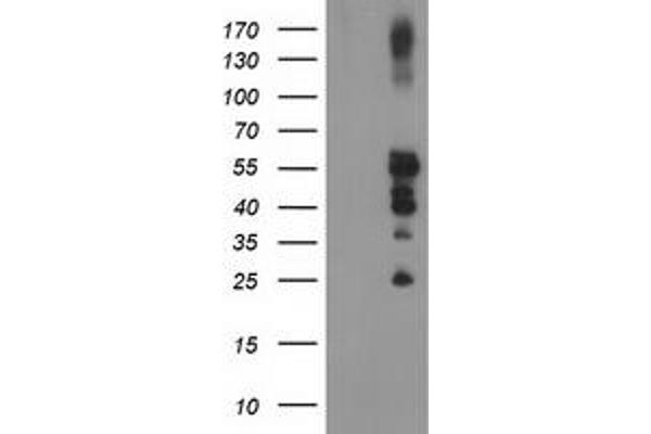 PTPN1 antibody