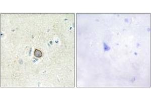 Immunohistochemistry analysis of paraffin-embedded human brain tissue, using CELSR3 Antibody. (CELSR3 antibody  (AA 91-140))