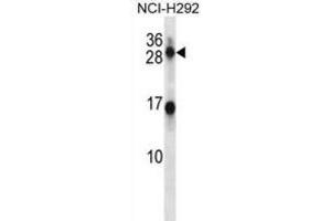 Western Blotting (WB) image for anti-Kallikrein 14 (KLK14) antibody (ABIN2998264)
