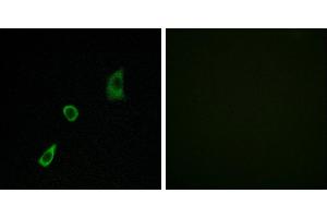Peptide - +Immunofluorescence analysis of HuvEc cells, using FGF23 antibody. (FGF23 antibody)