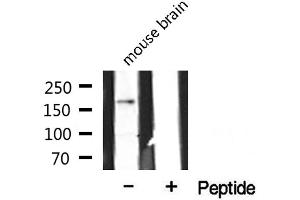 Western blot analysis of extracts from mouse brain, using CLASP1 antibody. (CLASP1 antibody  (Internal Region))