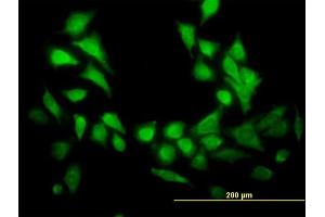 Immunofluorescence of  purified  MaxPab antibody to GENX-3414 on HeLa cell. (STBD1 antibody  (AA 1-358))