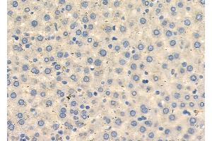 ABIN6262420 and ABIN6272672 at 1/100 staining Rat liver tissue by IHC-P. (HTR3D antibody  (Internal Region))