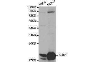 Western blot analysis of extracts of various cell lines, using SOD1 antibody (ABIN5970104) at 1/1000 dilution. (SOD1 antibody)