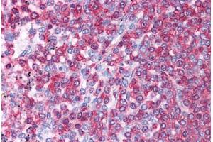 Human Spleen: Formalin-Fixed, Paraffin-Embedded (FFPE) (Hsc70 antibody  (AA 143-192))