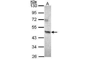 WB Image Sample (30 ug of whole cell lysate) A: 293T 10% SDS PAGE antibody diluted at 1:500 (Acad8 antibody)