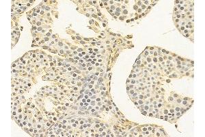 anti-CLK4-Associating Serine/arginine Rich Protein (CLASRP) (Internal Region) antibody