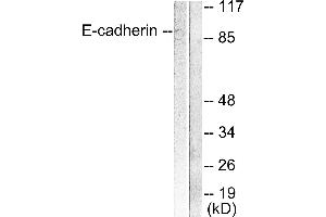 Western blot analysis of extracts from 293 cells, using E-cadherin antibody. (E-cadherin antibody)