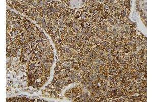 ABIN6274096 at 1/100 staining Human pancreas tissue by IHC-P. (EPH Receptor B6 antibody  (Internal Region))