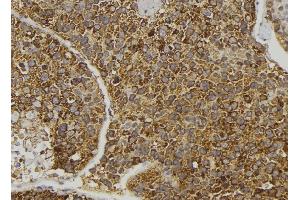 ABIN6274096 at 1/100 staining Human pancreas tissue by IHC-P. (EPH Receptor B6 antibody  (Internal Region))