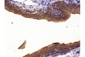 Paraformaldehyde-fixed, paraffin embedded Rat bladder Antigen retrieval by boiling in sodium citrate buffer (pH6. (Cytokeratin 1 antibody  (AA 141-240))
