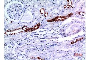 KRT8 antibody  (Ser726, Ser731)