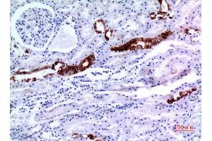 Immunohistochemistry (IHC) analysis of paraffin-embedded Human Kidney, antibody was diluted at 1:100. (KRT8 antibody  (Ser726, Ser731))