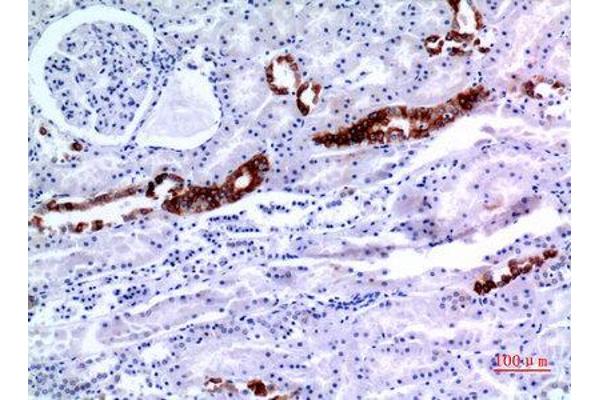 KRT8 antibody  (Ser726, Ser731)