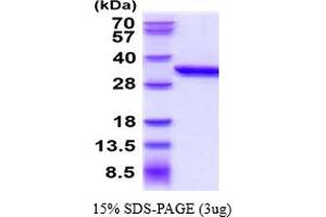 SDS-PAGE (SDS) image for Anthrax Toxin Receptor 2 (ANTXR2) (AA 32-318) protein (His tag) (ABIN6387780)